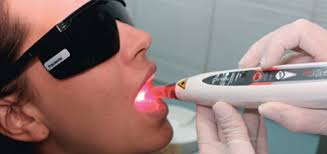 Paciente recebendo tratamento de laserterapia odontológica